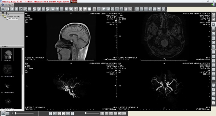 �����η򹯿��ǡ�Ǿ�ɥå� MRI ���� CD-ROM ���Ϥ������ɡ����ѥӥ塼�����ץ�λȤ�����������äƥ參���! // Ǿ�ߥ����������ƵͤޤäƤ�����ϥ參�å�